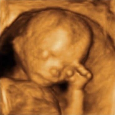 Ecografía 3D real de la cara de un bebé con la mano cerca de la boca.